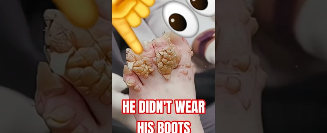 THIS IS WHY TRUCKERS WEAR BOOTS! NO FLIP FLOPS IN TRUCKING!