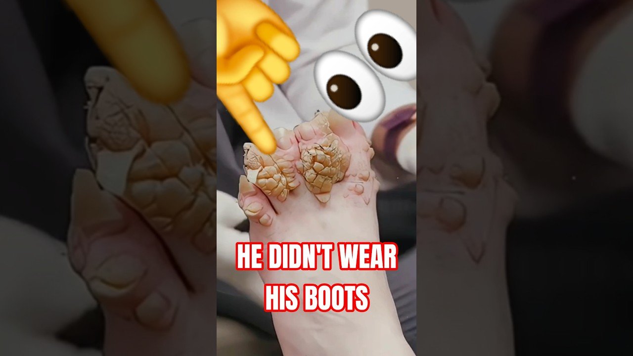 THIS IS WHY TRUCKERS WEAR BOOTS! NO FLIP FLOPS IN TRUCKING!