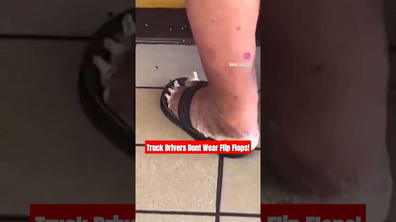 Truckers Dont Wear Flip Flops! You should be ashamed of yourself, Driver. Go put on some boots!