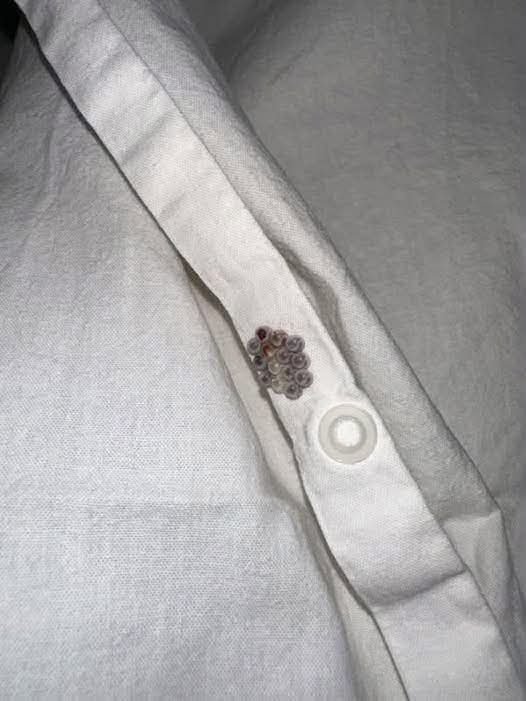 Found this on my sheets in the bunk... should I worry?