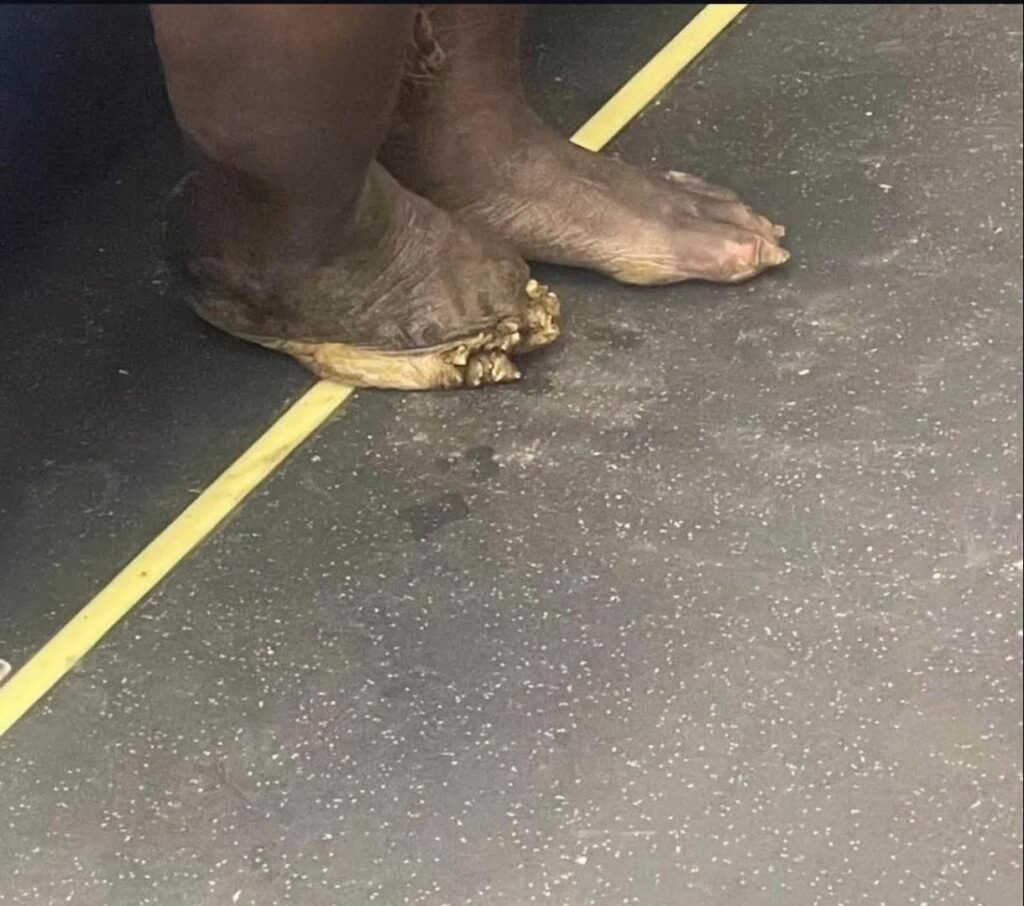 Maybe Flip Flops would have helped with this one.