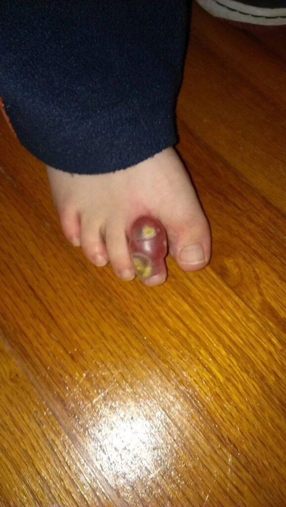 THIS IS WHY WE WEAR BOOTS!
