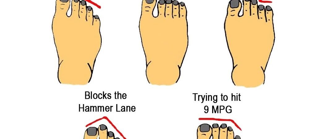 Which one are you? Be honest! 🚛🦶 #TruckerLife